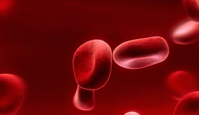 Asocian la anemia a mayor riesgo de deterioro cognitivo