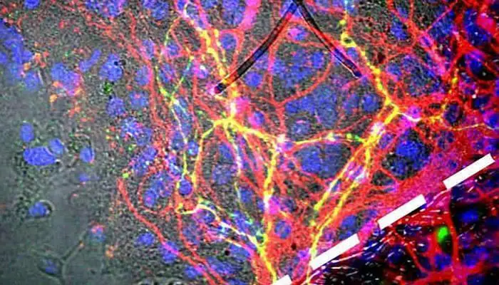 promesa para las terapias con células madre en la enfermedad de Parkinson
