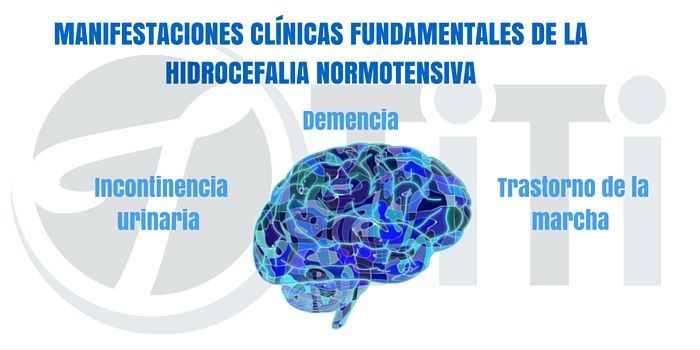 Algunas causas de demencia secundaria. (2)